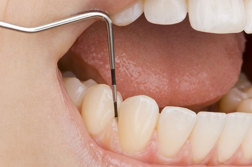 Periodontal - Sonrisas para todos