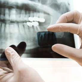 Radiografía - Sonrisas para todos
