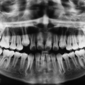 Radiografía panorámica - Sonrisas para todos