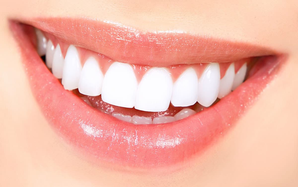 Sonrisa Mujer- Dentistas en costa rica - Sonrisas par todos