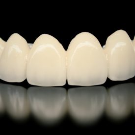 Dental crowns costa rica