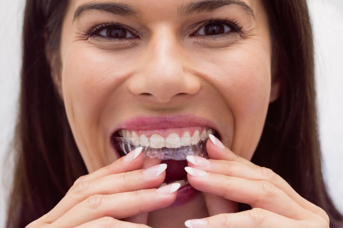 Ortodoncia Invisalign