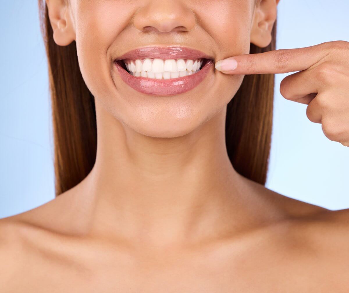 teeth whitening