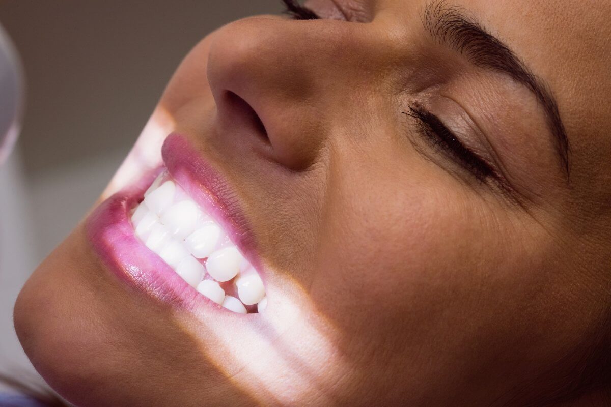 teeth whitening
