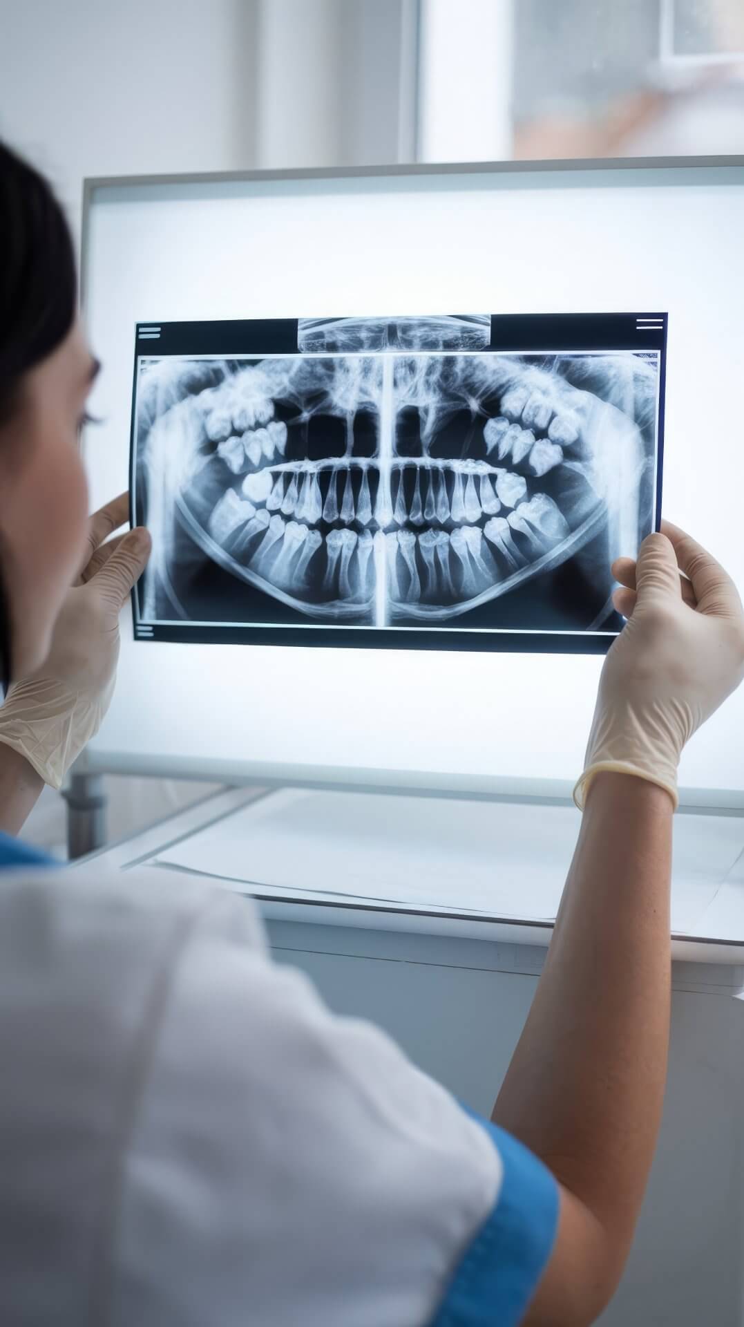 Radiografía dental digital - Sonrisa Para Todos Costa Rica