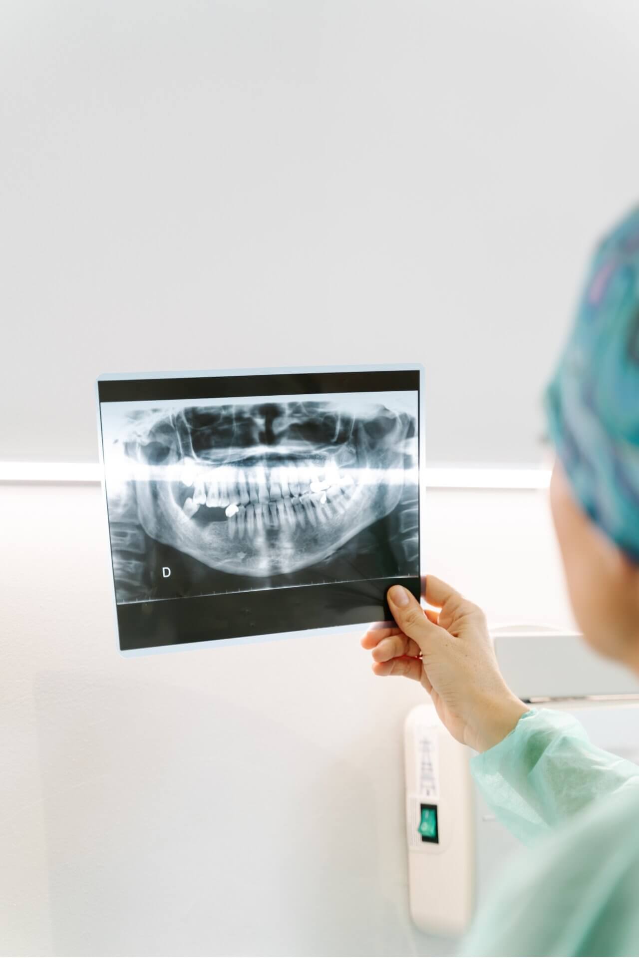 Equipos de radiografía digital - Sonrisa Para Todos Costa Rica
