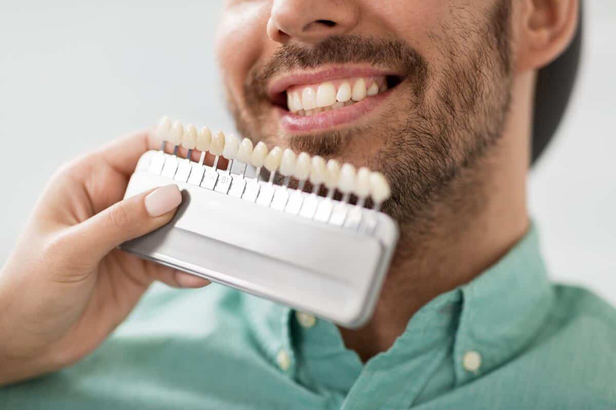 Candidata ideal para carillas dentales - Sonrisa Para Todos