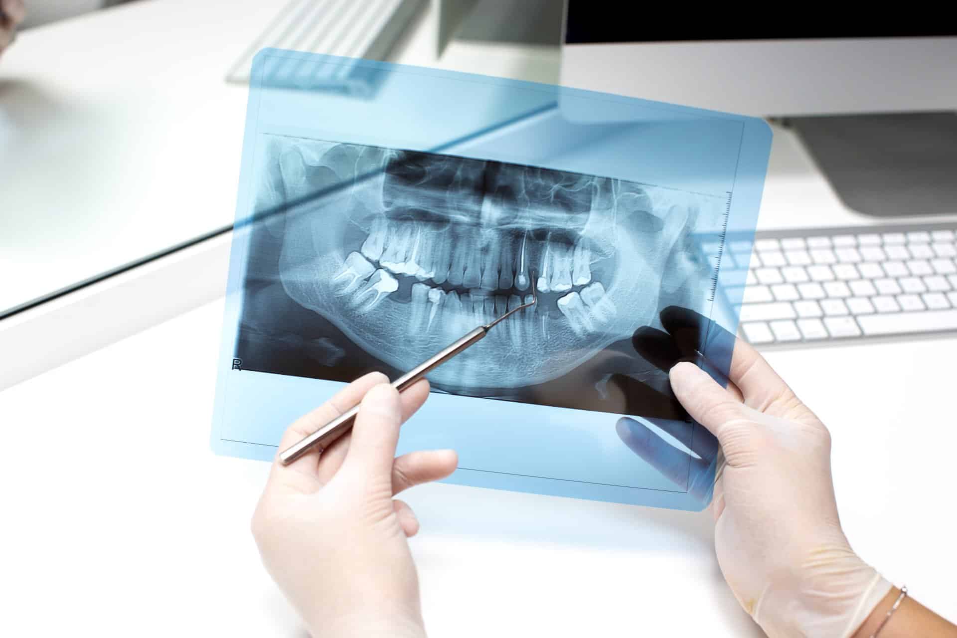 Diagnóstico CBCT 3D para cordales - Sonrisa Para Todos