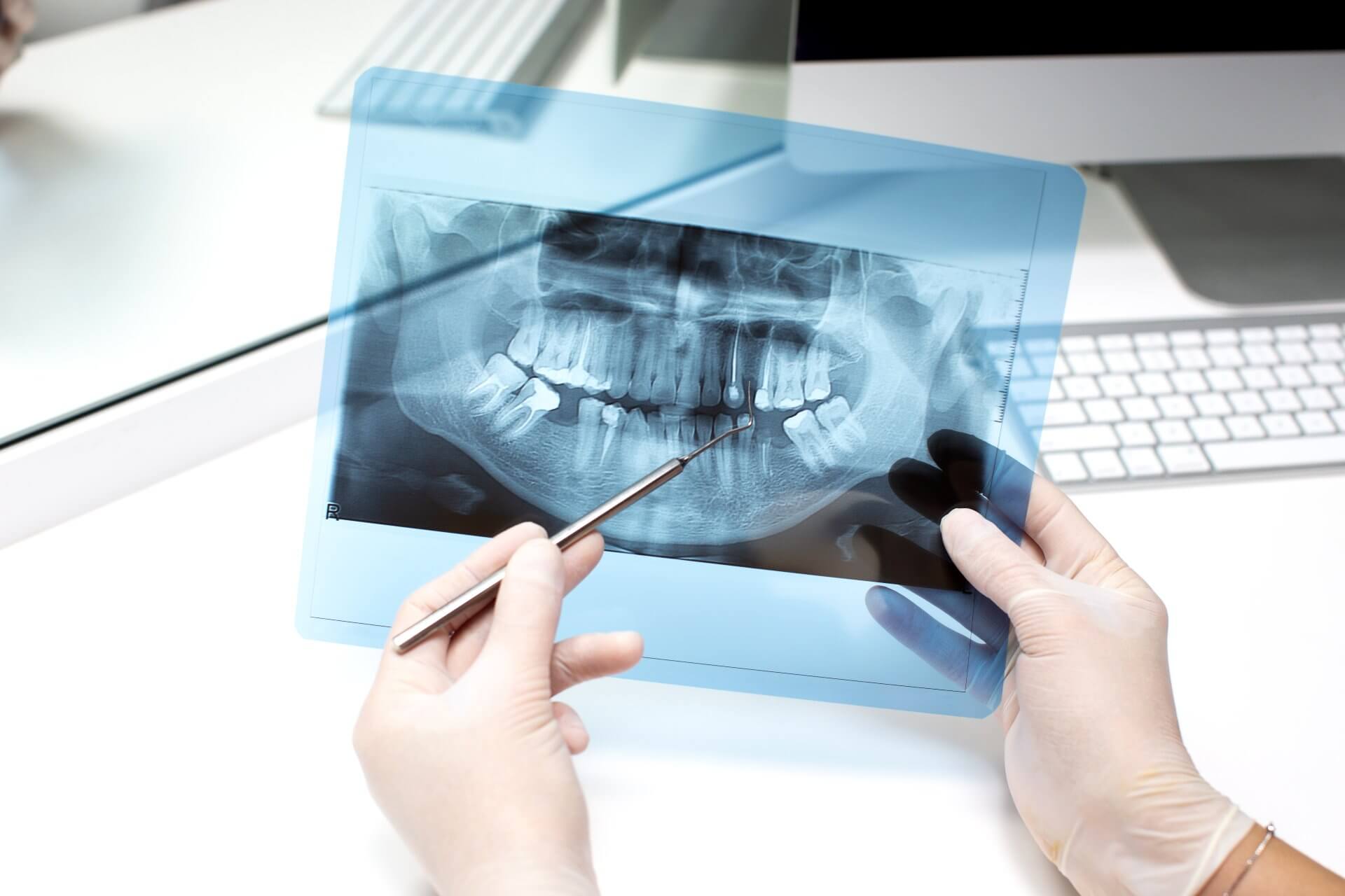 Odontólogo analizando radiografía dental - Sonrisa Para Todos