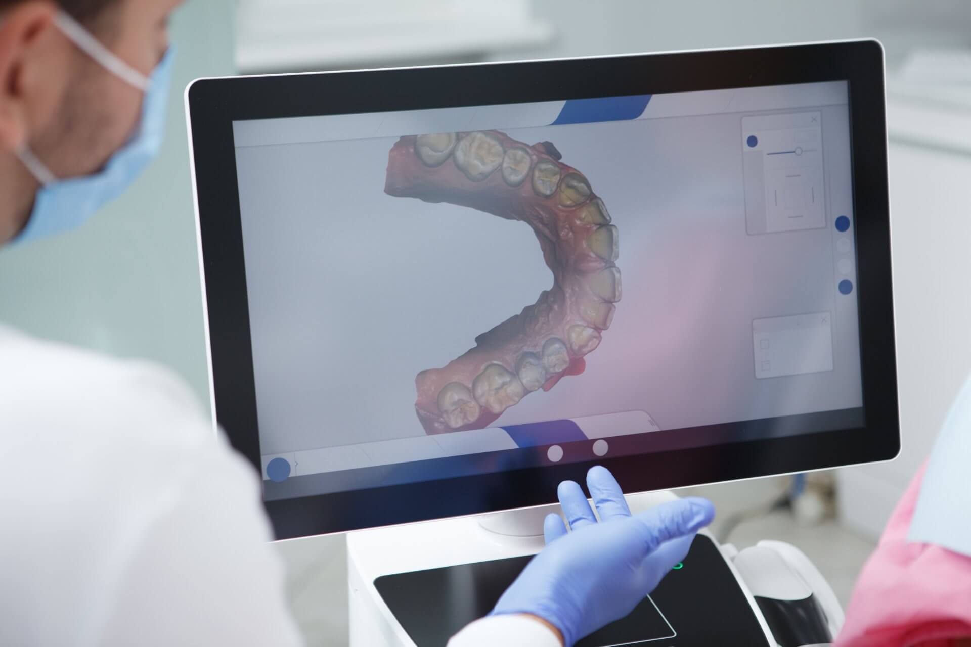 Planificación digital de ortodoncia 3D - Sonrisa Para Todos