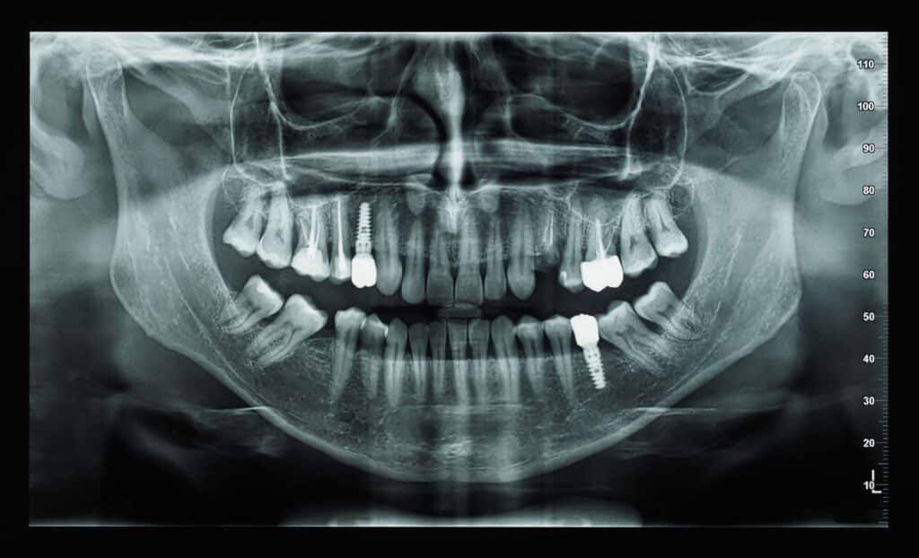 Radiografia
