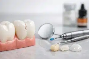 Cómo reparar un diente fracturado: opciones