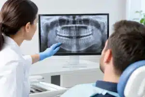 Radiografía panorámica dental: ¿para qué sirve?